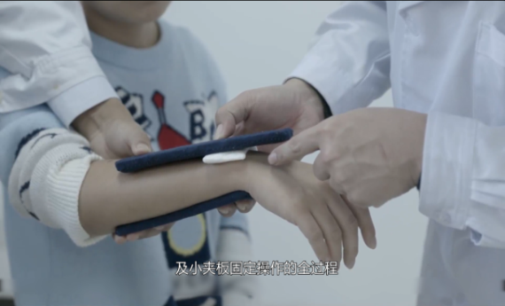 小夹板固定图1